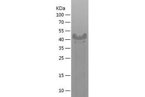 EXT2 Protein (AA 46-264) (His-IF2DI Tag)