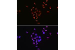 Immunofluorescence analysis of HeLa cells using Phospho-p70 S6 Kinase 1-T421/S424 antibody (ABIN6135340, ABIN6136296, ABIN6136297 and ABIN7101878). (RPS6KB1 抗体  (pSer424, pThr421))