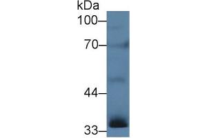 Western blot analysis of Rat Testis lysate, using Human INHA Antibody (5 µg/ml) and HRP-conjugated Goat Anti-Rabbit antibody ( (Inhibin alpha 抗体  (AA 25-363))