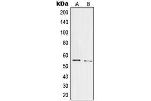 Western blot analysis of PRPF19 expression in HepG2 (A), HeLa (B) whole cell lysates. (PRP19 抗体  (Center))