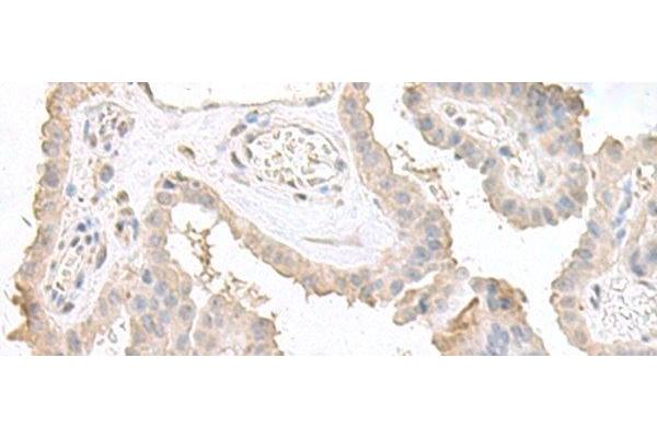 Double-stranded RNA-binding protein Staufen homolog 2 (STAU2) 抗体