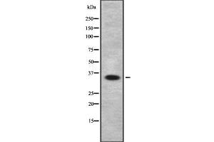 Western blot analysis OR2T5/2T29 using HeLa whole cell lysates (OR2T5/2T29 抗体)