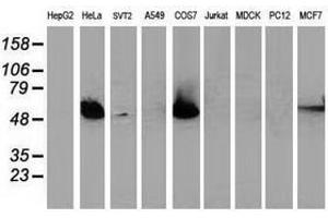Image no. 2 for anti-Tumor Protein P53 (TP53) antibody (ABIN1499975) (p53 抗体)