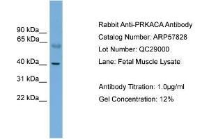 WB Suggested Anti-PRKACA  Antibody Titration: 0. (PRKACA 抗体  (N-Term))
