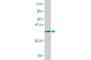 Western Blot detection against Immunogen (36. (TLX3 抗体  (AA 192-291))