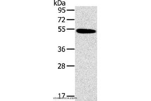Western blot analysis of Human normal colon tissue, using HRH1 Polyclonal Antibody at dilution of 1:200 (HRH1 抗体)