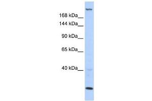 TNRC6B antibody used at 1 ug/ml to detect target protein. (TNRC6B 抗体  (N-Term))