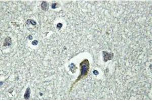 Image no. 2 for anti-Parathyroid Hormone 1 Receptor (PTH1R) antibody (ABIN317698) (PTH1R 抗体)
