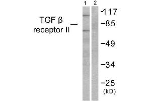 Western Blotting (WB) image for anti-Transforming Growth Factor, beta Receptor II (70/80kDa) (TGFBR2) (Internal Region) antibody (ABIN1848792) (TGFBR2 抗体  (Internal Region))