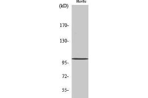 Western Blotting (WB) image for anti-N(alpha)-Acetyltransferase 15, NatA Auxiliary Subunit (NAA15) (Internal Region) antibody (ABIN6281956) (NAA15 抗体  (Internal Region))