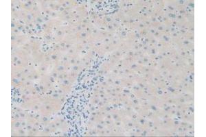 IHC-P analysis of Human Liver Tissue, with DAB staining. (SQSTM1 抗体  (AA 136-400))