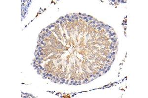Immunohistochemistry of paraffin embedded mouse lung using MLF1 (ABIN7074712) at dilution of 1: 1500 (400x lens) (MLF1 抗体)