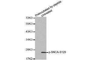 Western blot analysis of extracts from mouse brain tissue, using Phospho-SNCA-S129 antibody (ABIN2988301). (SNCA 抗体  (pSer129))