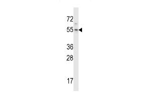 Western blot analysis in Hela cell line lysates (35ug/lane). (H13 抗体  (C-Term))