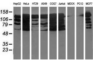 Western blot analysis of extracts (35 µg) from 9 different cell lines by using anti-BUB1B monoclonal antibody. (BUB1B 抗体)