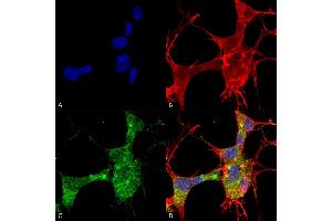 Immunocytochemistry/Immunofluorescence analysis using Mouse Anti-GFAP Monoclonal Antibody, Clone S206A-8 (ABIN1740957). (GFAP 抗体  (AA 411-422) (FITC))