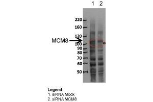 MCM8 WB Sample: siRNA Mock and siRNA MCM8 Dilution 1:1000 (MCM8 抗体  (N-Term))