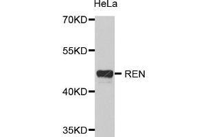 Western Blotting (WB) image for anti-Renin (REN) (AA 24-160) antibody (ABIN6218656) (Renin 抗体  (AA 24-160))