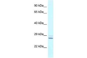 Western Blot showing TPPP antibody used at a concentration of 1 ug/ml against Fetal Liver Lysate (Tppp 抗体  (N-Term))