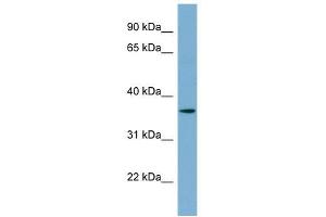 C1ORF75 antibody used at 1 ug/ml to detect target protein. (TMEM206 抗体  (N-Term))