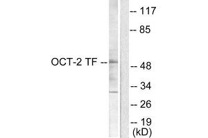 Western Blotting (WB) image for anti-POU domain, class 2, transcription factor 2 (POU2F2) (N-Term) antibody (ABIN1848707) (Oct-2 抗体  (N-Term))