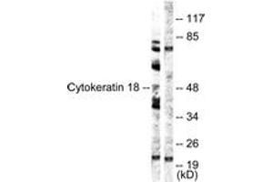 Western blot analysis of extracts from HuvEc cells, using Keratin 18 (Ab-52) Antibody. (Cytokeratin 18 抗体  (AA 21-70))