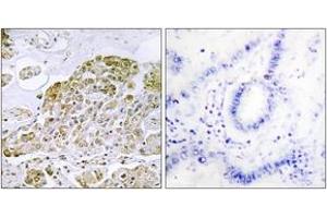 Immunohistochemistry (IHC) image for anti-Transcription Factor EB (TFEB) (AA 10-59) antibody (ABIN2889416) (TFEB 抗体  (AA 10-59))