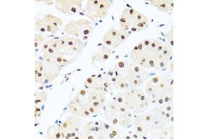 Immunohistochemistry of paraffin-embedded human stomach using RAB3IP antibody. (RAB3IP 抗体  (AA 1-150))