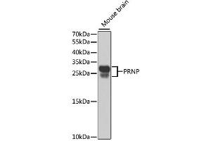 Western blot analysis of extracts of mouse brain, using PRNP antibody. (PRNP 抗体)