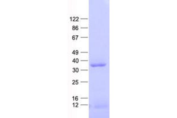 CDX1 Protein (His tag)