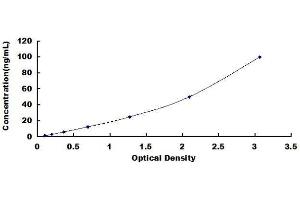 ELISA image for Phospholipase D2 (PLD2) ELISA Kit (ABIN1571927) (Phospholipase D2 ELISA 试剂盒)