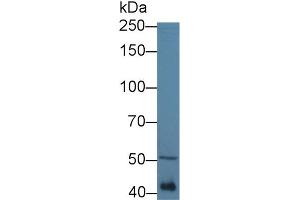 Western Blot; Sample: Mouse Serum; Primary Ab: 1µg/ml Rabbit Anti-Mouse MTUS1 Antibody Second Ab: 0. (MTUS1 抗体  (AA 1020-1210))