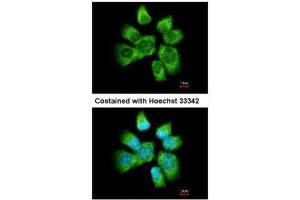 ICC/IF Image Immunofluorescence analysis of methanol-fixed A431, using AHA-1, antibody at 1:500 dilution. (AHSA1 抗体  (Center))