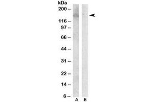 Western blot testing of Jurkat lysate with HER3 antibody at 0. (ERBB3 抗体)