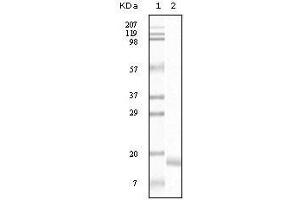 Western Blot showing SNCA antibody used against truncated SNCA recombinant protein. (SNCA 抗体)