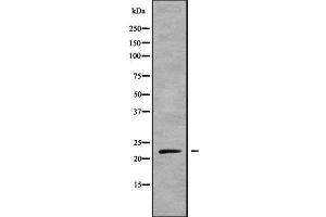 Western blot analysis NKIRAS1 using mouse liver lysates (NKIRAS1 抗体  (C-Term))