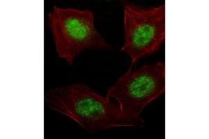 Fluorescent image of A549 cell stained with hARNT-V528. (ARNT 抗体  (AA 513-544))