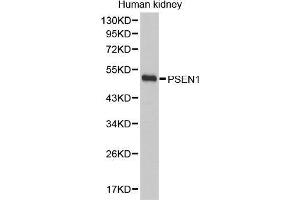 Western Blotting (WB) image for anti-Presenilin 1 (PSEN1) (AA 1-160) antibody (ABIN6219418) (Presenilin 1 抗体  (AA 1-160))