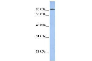 CLPB antibody used at 1 ug/ml to detect target protein. (CLPB 抗体)