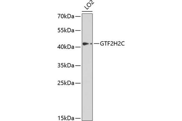 GTF2H2C 抗体  (AA 1-300)