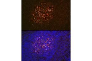 Immunofluorescence analysis of rat spleen using CR2/CD21 Rabbit mAb (ABIN1678995, ABIN3015431, ABIN3015432 and ABIN7101406) at dilution of 1:100 (40x lens). (CD21 抗体)