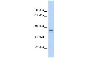 GAPDH antibody used at 1 ug/ml to detect target protein. (GAPDH 抗体  (Middle Region))