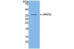 Detection of Recombinant ITGb3, Human using Polyclonal Antibody to Integrin Beta 3 (ITGb3) (Integrin beta 3 抗体  (AA 135-377))