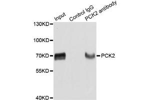 Immunoprecipitation analysis of extracts of HepG2 cells using PCK2 antibody. (PEPCK 抗体)