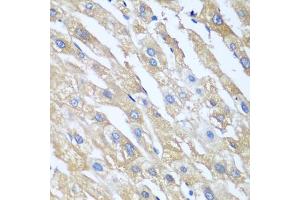 Immunohistochemistry of paraffin-embedded human liver using PPP4R1 antibody. (PPP4R1 抗体)