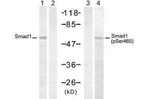 Western blot analysis of extract from 293 cells, untreated or treated with PMA (200nM, 30min), using Smad1 (Ab-465) Antibody (E021321, Lane 1 and 2) and Smad2 (Phospho-Ser465) Antibody (E011321, Lane 3 and 4). (SMAD1 抗体)
