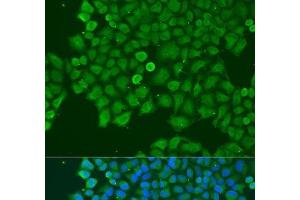 Immunofluorescence analysis of U2OS cells using CAST Polyclonal Antibody at dilution of 1:100. (Calpastatin 抗体)