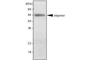 The extract of mouse liver was resolved by SDS-PAGE, transferred to PVDF membrane and probed with anti-human adiponectin antibody (1:2000). (ADIPOQ 抗体  (AA 15-244))