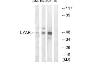 Western Blotting (WB) image for anti-Ly1 Antibody Reactive (LYAR) (Internal Region) antibody (ABIN1851050) (LYAR 抗体  (Internal Region))