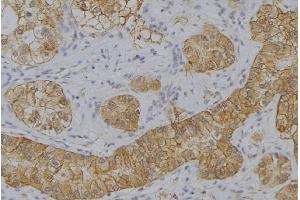 ABIN6273644 at 1/100 staining Human uterus tissue by IHC-P. (IFNA2 抗体  (N-Term))